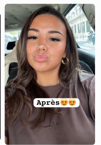 Après