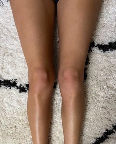 Après